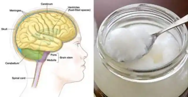 Here's How Coconut Oil Could Prevent and Treat Alzheimer's Disease