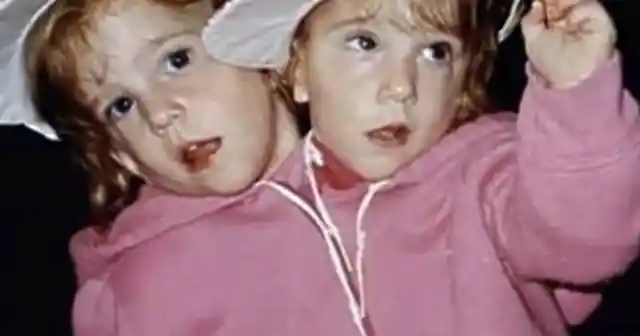 25+ Interesting Facts About Famous Conjoined Twins Abby And Brittany Hensel