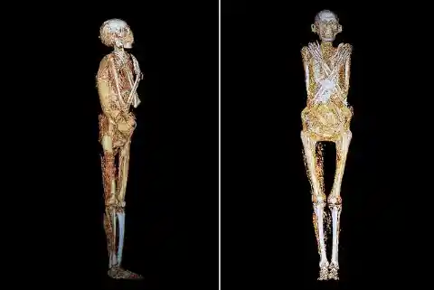 Researchers Give Mummified Man A CTE Scan, You Won't Believe What They Find