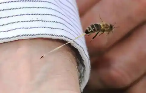 Bee Stings Hurt The Bee