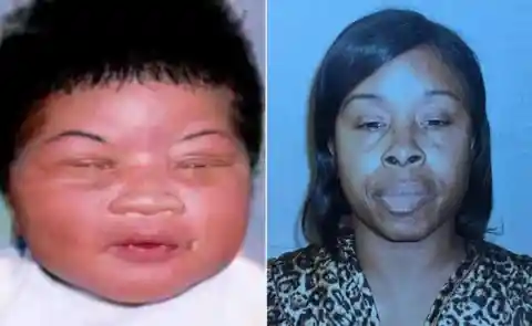 This Baby Was Thought To Be Dead, Found Alive 18 Years Later